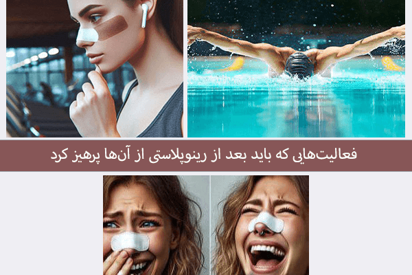 فعالیت هایی که باید بعد از رینوپلاستی از آن ها پرهیز کرد
