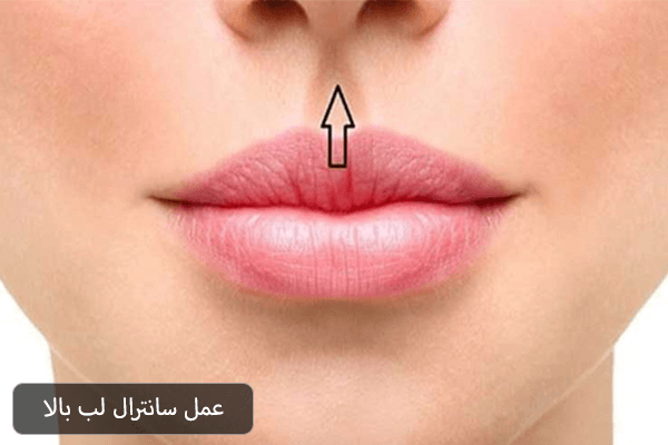 عمل سانترال لب بالا
