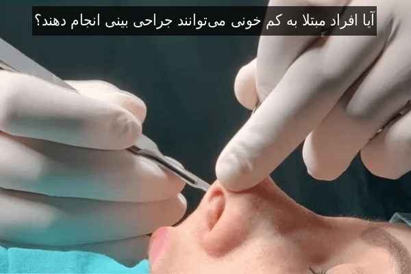 آیا افراد مبتلا به کم خونی می‌توانند جراحی بینی انجام دهند؟