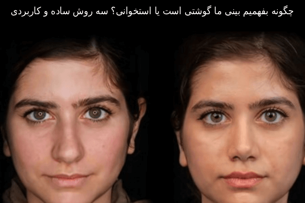 چگونه بفهمیم بینی ما گوشتی است یا استخوانی؟