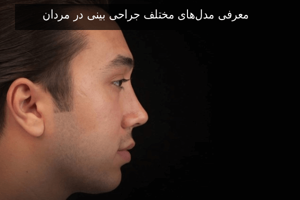 معرفی مدلهای مختلف جراحی بینی در مردان