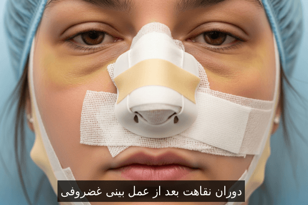 دوران نقاهت بعد از عمل بینی غضروفی
