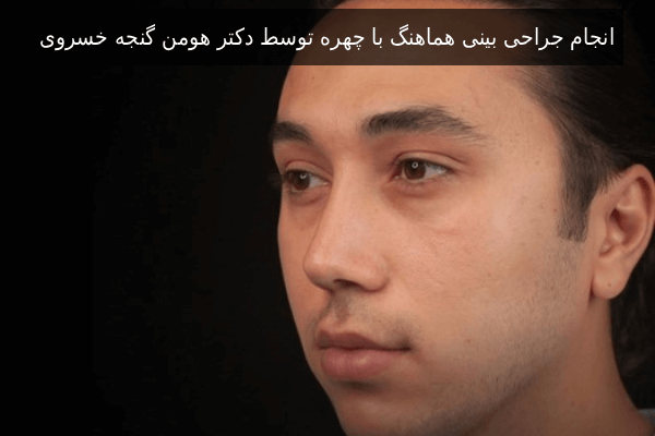 انجام جراحی بینی هماهنگ با چهره توسط دکتر هومن گنجه خسروی 