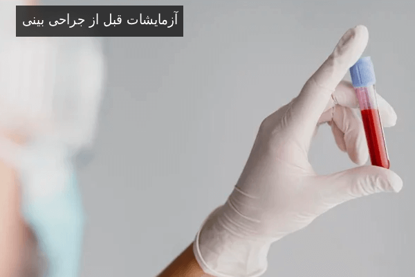 آزمایشات قبل از جراحی بینی