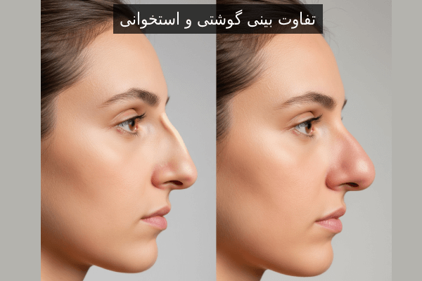 تفاوت بینی گوشتی و استخوانی