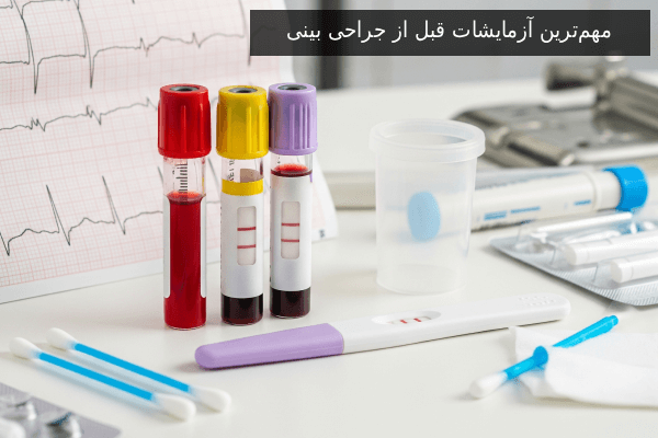 مهم‌ترین آزمایشات قبل از جراحی بینی