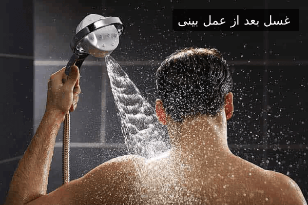 غسل بعد از عمل بینی
