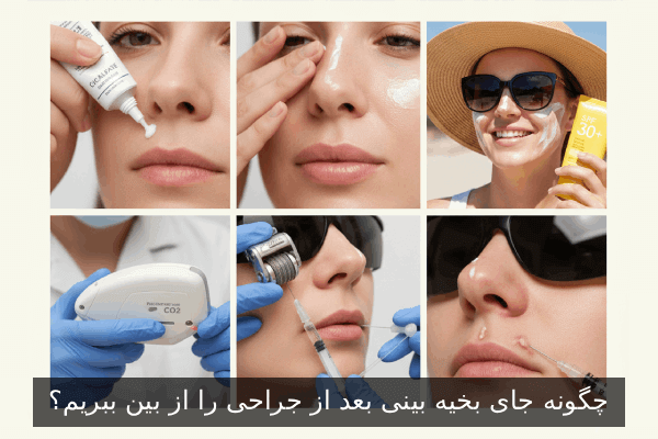 چگونه جای بخیه بینی بعد از جراحی را از بین ببریم؟