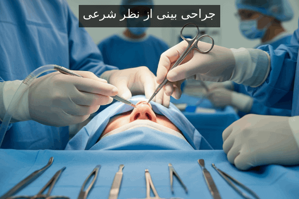جراحی بینی از نظر شرعی