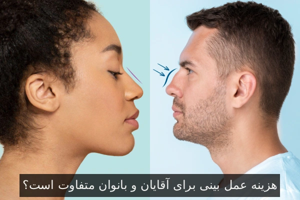 هزینه عمل بینی برای آقایان و بانوان متفاوت است؟