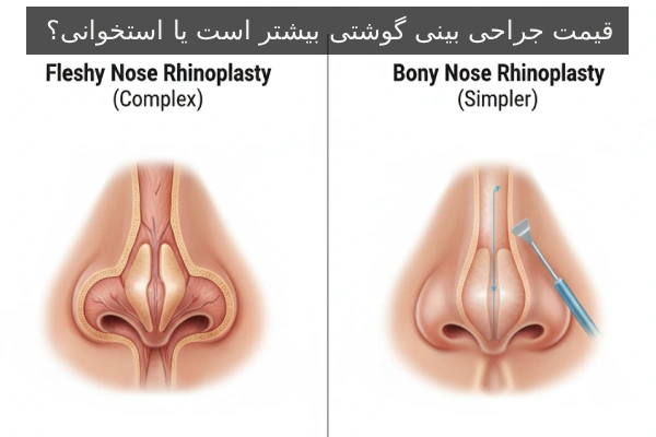 قیمت جراحی بینی گوشتی بیشتر است یا استخوانی؟