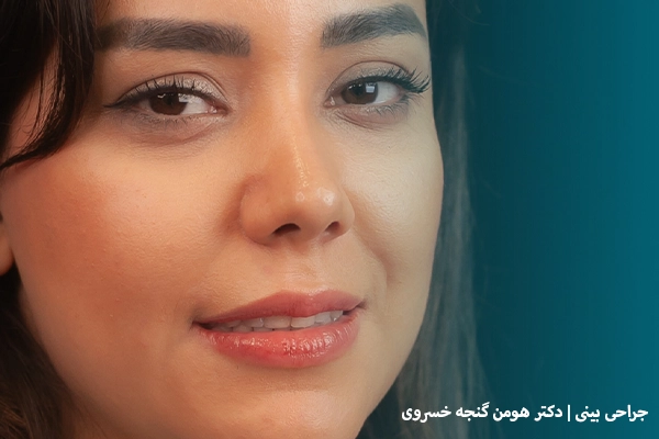جراحی بینی طبیعی