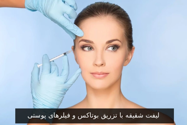 لیفت شقیقه با تزریق بوتاکس و فیلرهای پوستی