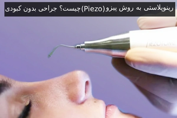 رینوپلاستی به روش پیزو (Piezo) چیست؟ جراحی بدون کبودی