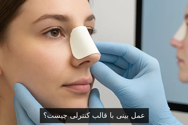 عمل بینی با قالب کنترلی چیست؟