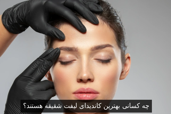 چه کسانی بهترین کاندیدای لیفت شقیقه هستند؟