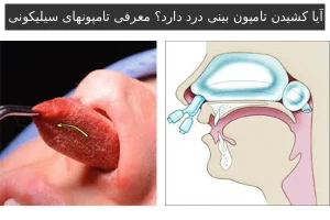 آیا کشیدن تامپون بینی درد دارد؟ معرفی تامپونهای سیلیکونی