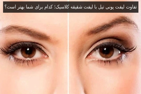 تفاوت لیفت پونی تیل با لیفت شقیقه کلاسیک؛ کدام برای شما بهتر است؟