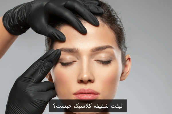 لیفت شقیقه کلاسیک چیست؟