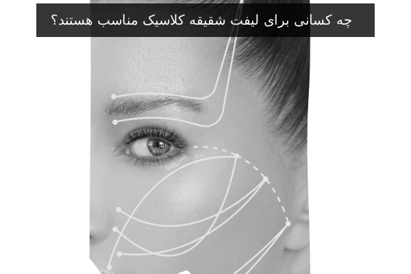 چه کسانی برای لیفت شقیقه کلاسیک مناسب هستند؟