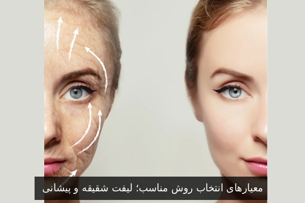 معیارهای انتخاب روش مناسب؛ لیفت شقیقه و پیشانی