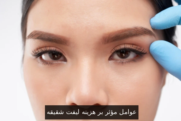 عوامل مؤثر بر هزینه لیفت شقیقه
