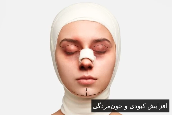 افزایش کبودی و خون‌مردگی
