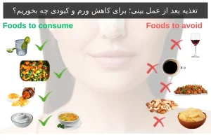 تغذیه بعد از عمل بینی؛ برای کاهش ورم و کبودی چه بخوریم؟