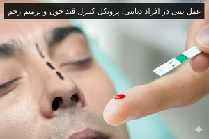 عمل بینی در افراد دیابتی؛ پروتکل کنترل قند خون و ترمیم زخم