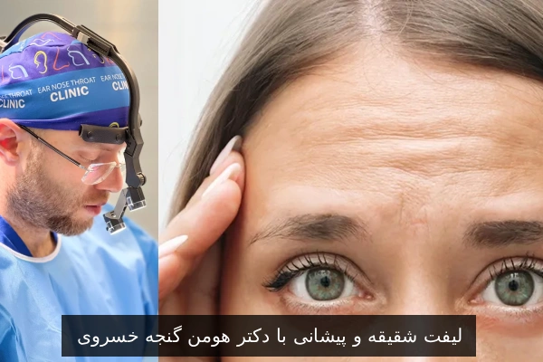 لیفت شقیقه و پیشانی با دکتر هومن گنجه خسروی