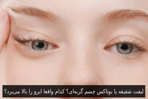 لیفت شقیقه یا بوتاکس چشم گربه‌ای؟ کدام واقعا ابرو را بالا می‌برد؟