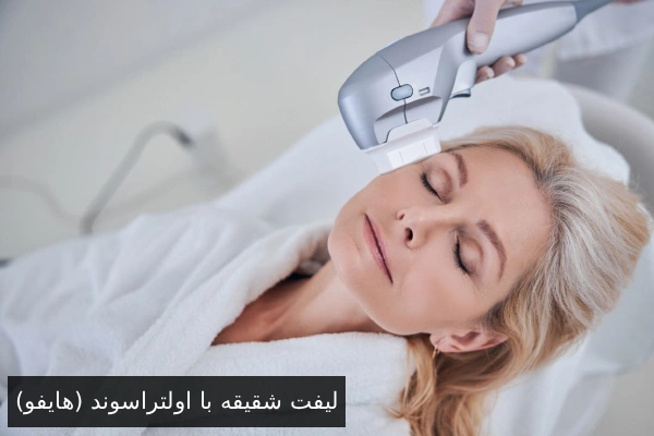 لیفت شقیقه با اولتراسوند (هایفو)