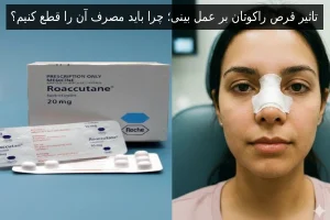 تاثیر قرص راکوتان بر عمل بینی؛ چرا باید مصرف آن را قطع کنیم؟