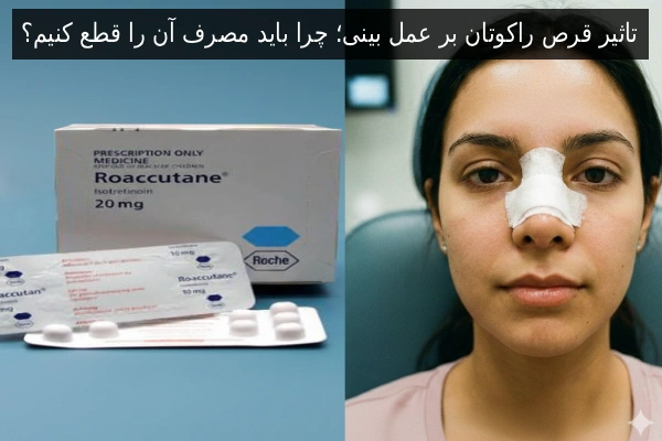 تاثیر قرص راکوتان بر عمل بینی؛ چرا باید مصرف آن را قطع کنیم؟